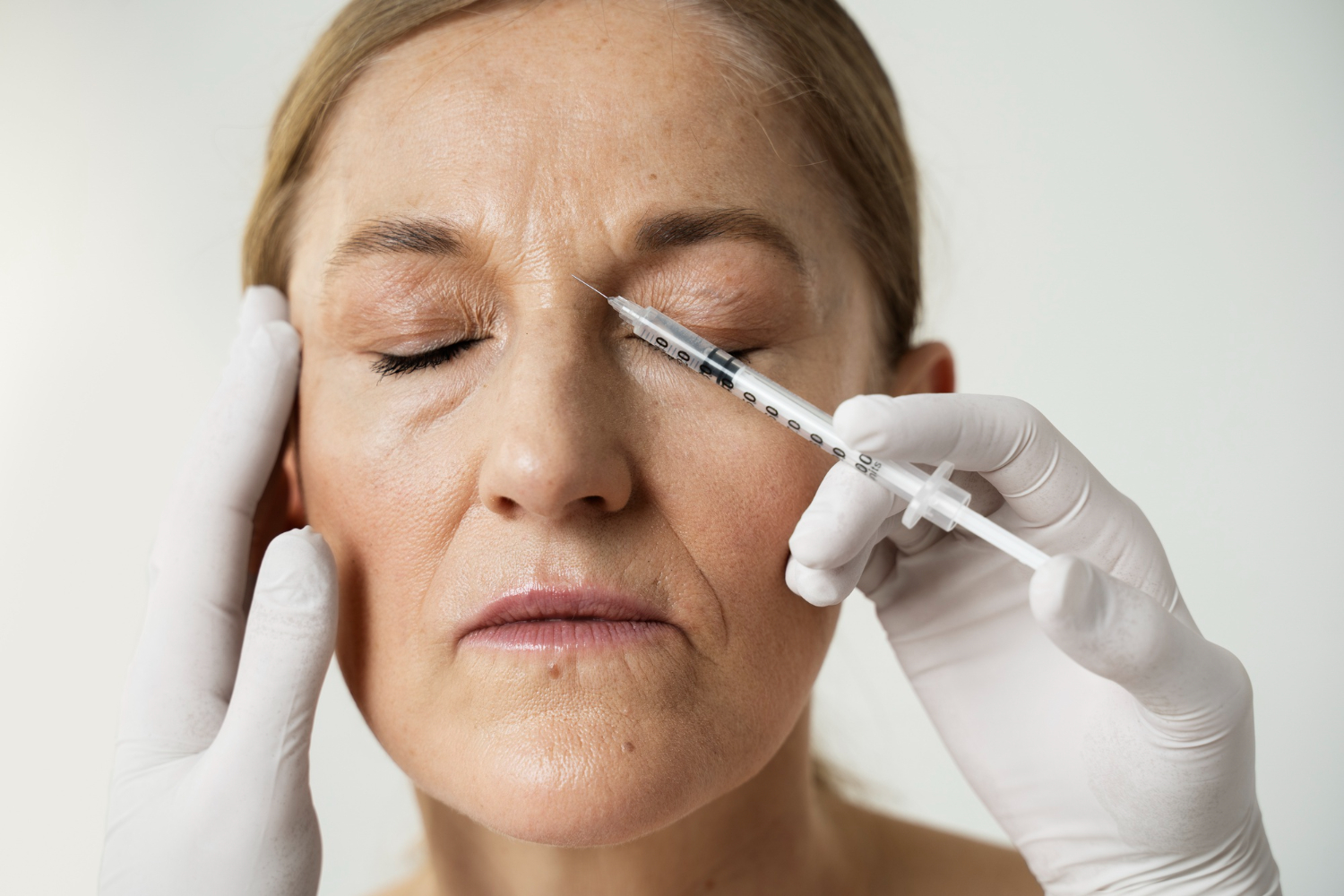 aplicação estética de tratamento para rugas em mulher